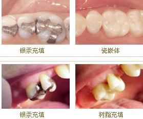 郑州补牙医院哪家比较好